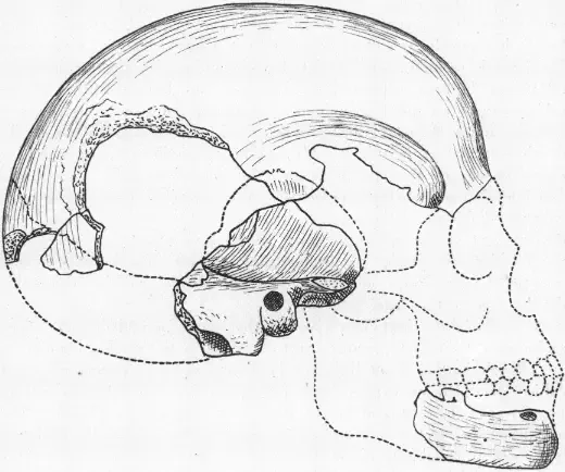Reconstruction of the Homo capensis skull from Robert Broom's 1918 paper. Shaded areas mark the bone actually recovered; the dotted outline shows the reconstructed missing sections.